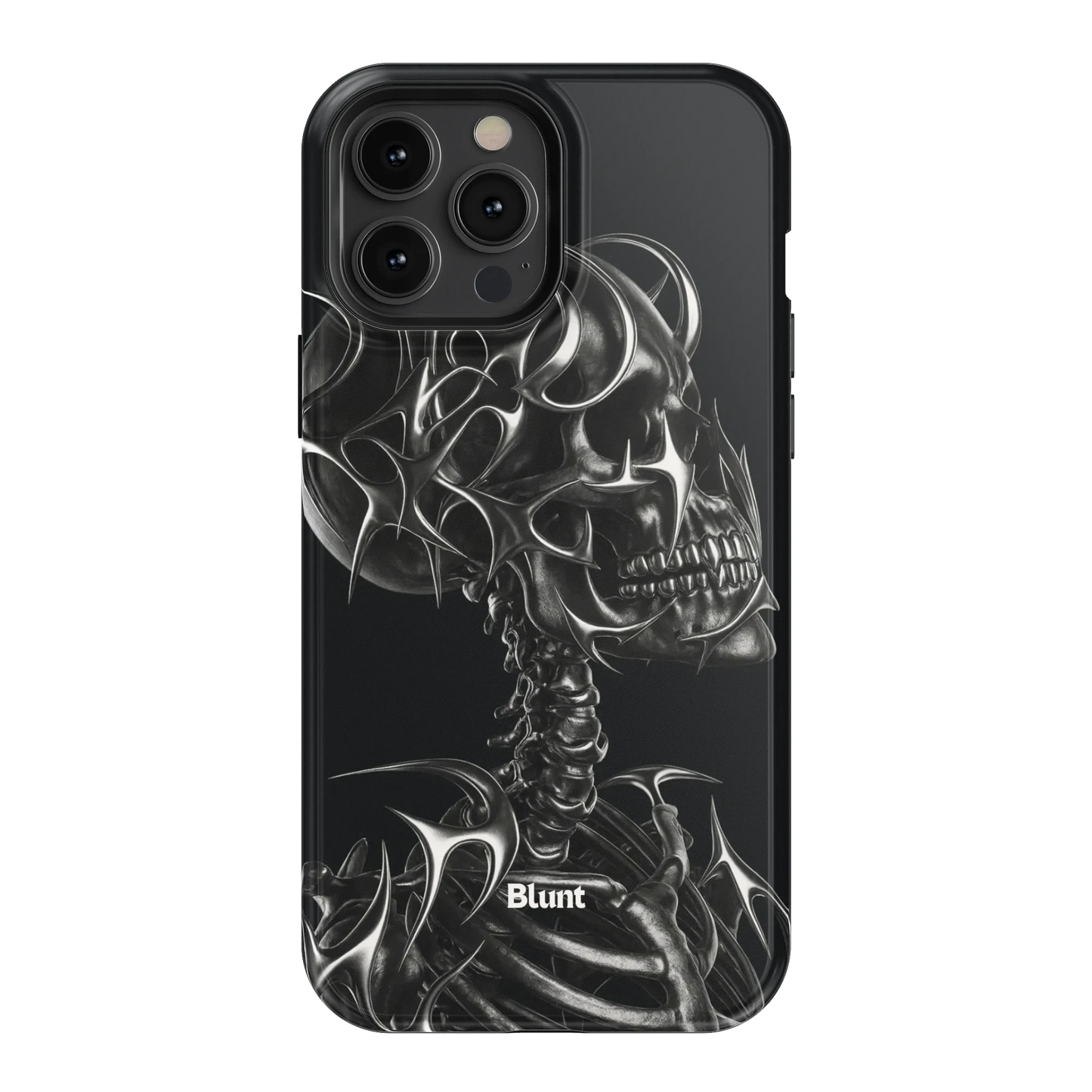 X-Ray iPhone Case