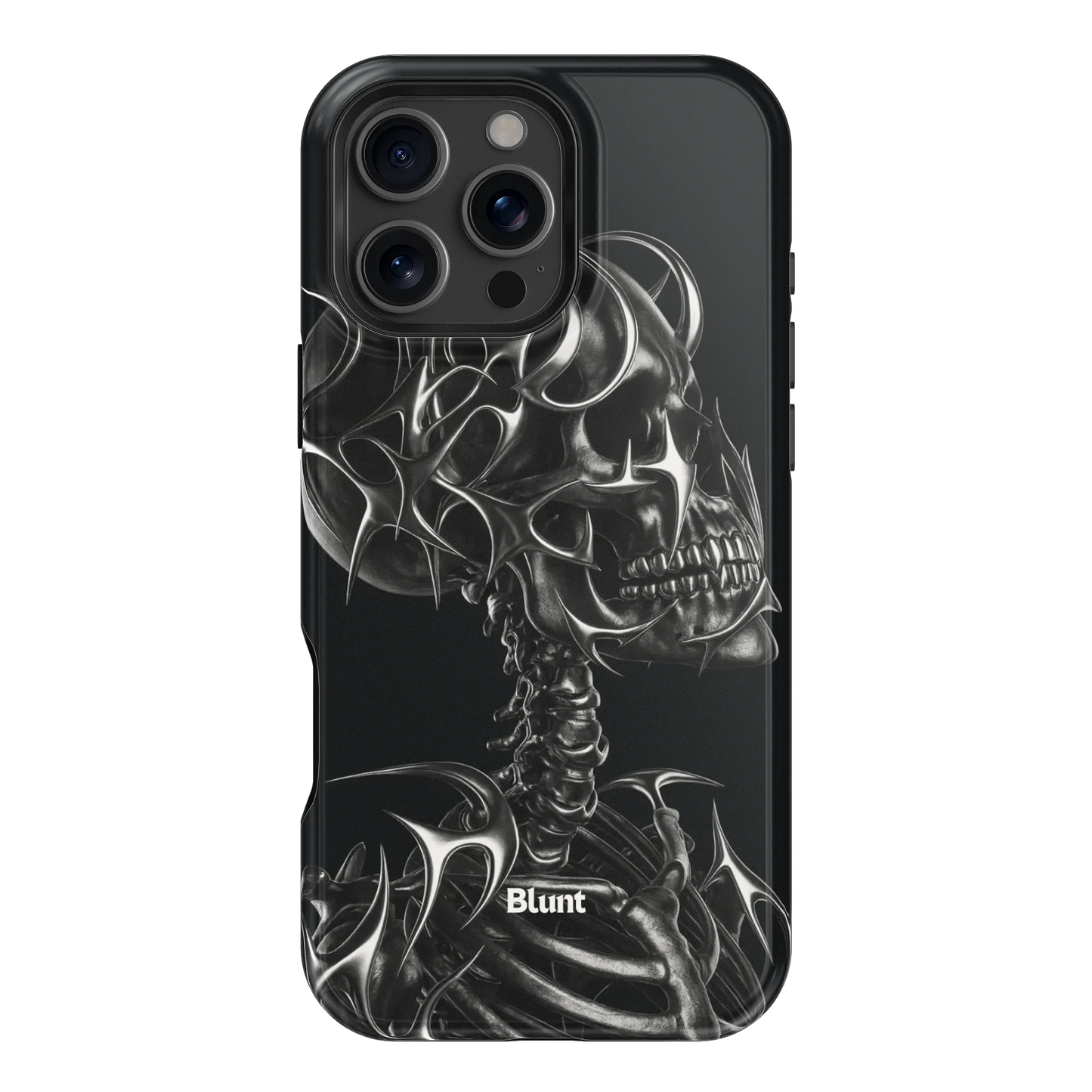 X-Ray iPhone Case
