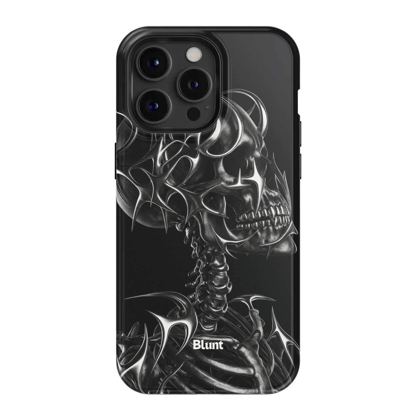 X-Ray iPhone Case