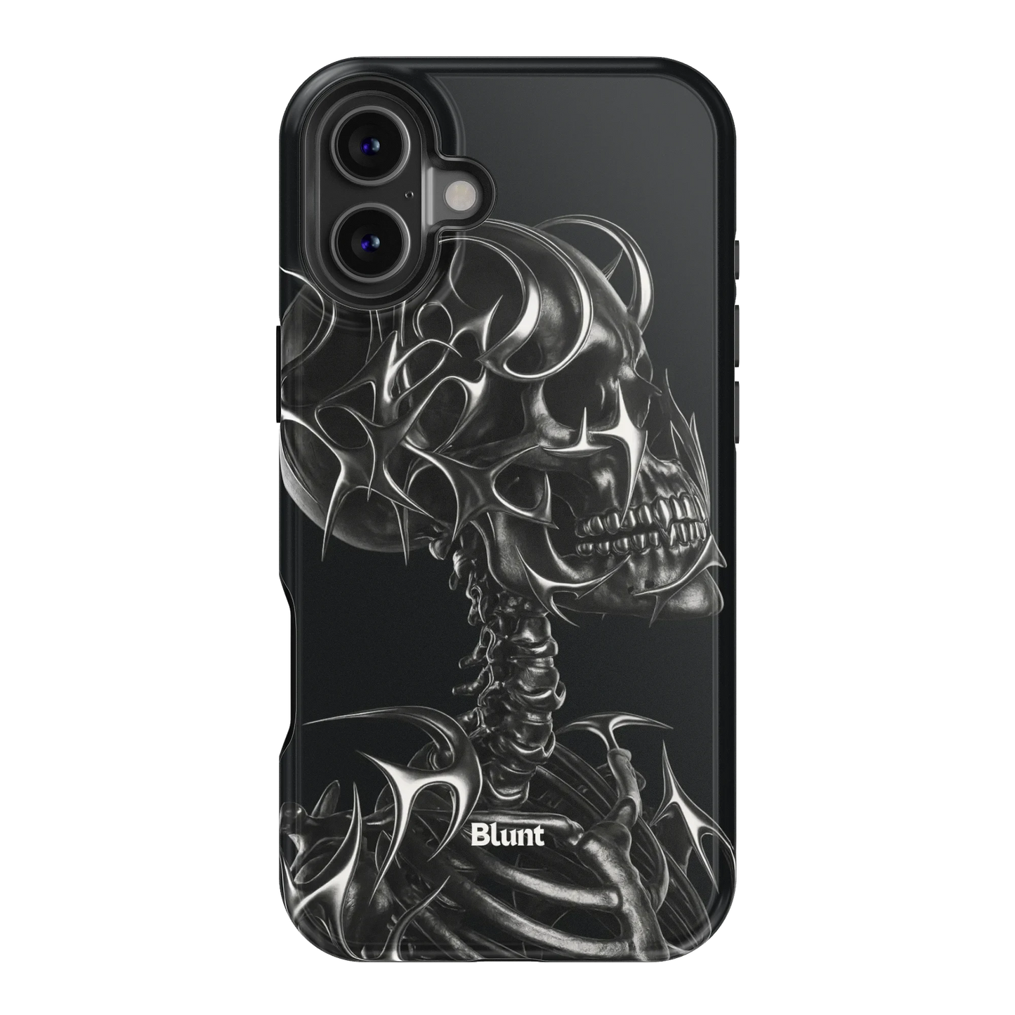 X-Ray iPhone Case