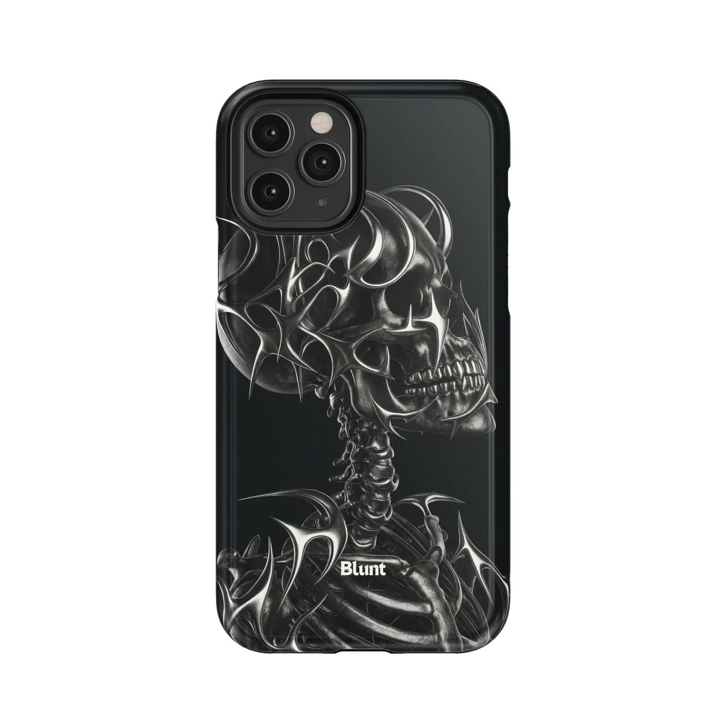 X-Ray iPhone Case