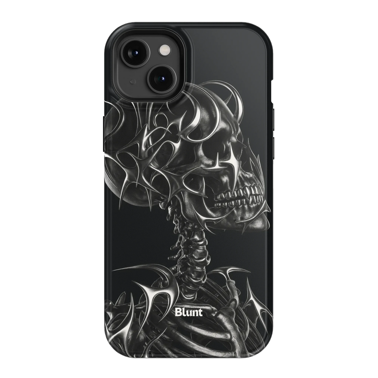 X-Ray iPhone Case