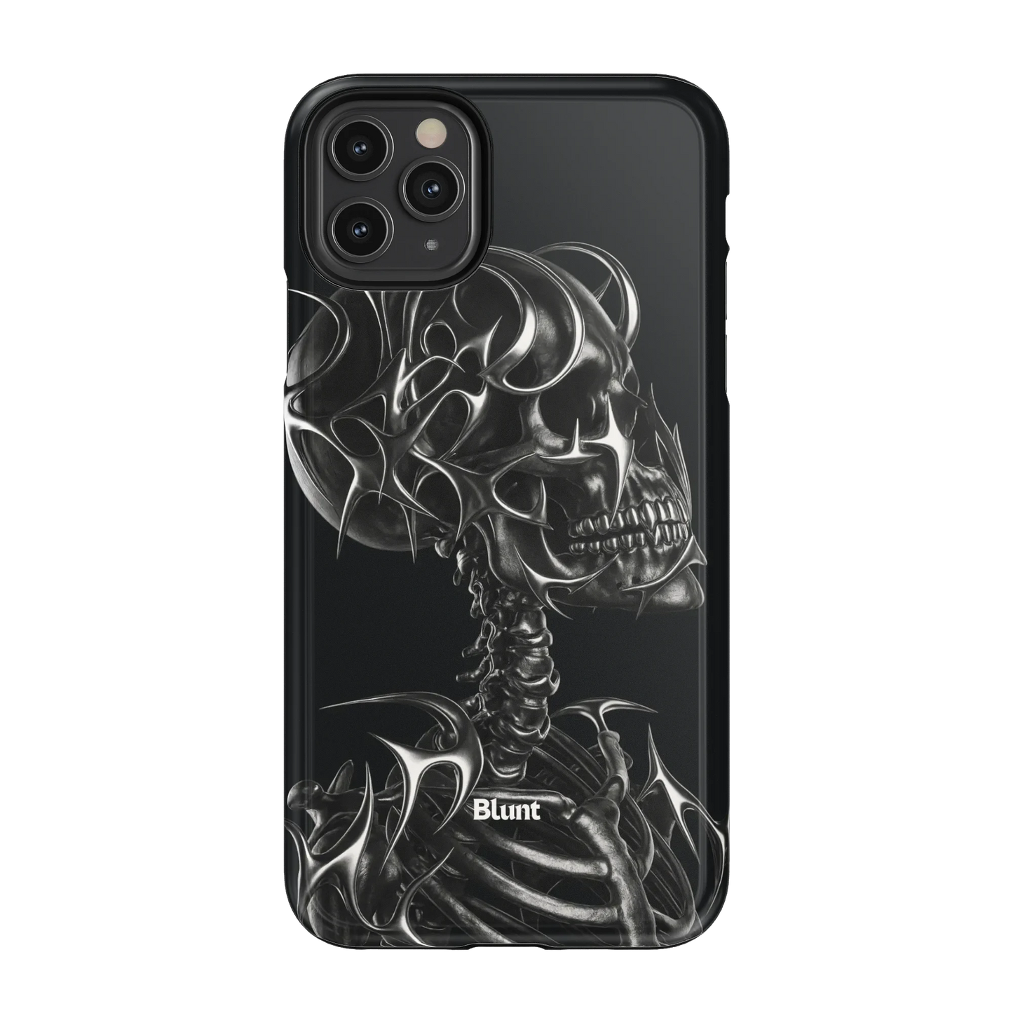 X-Ray iPhone Case