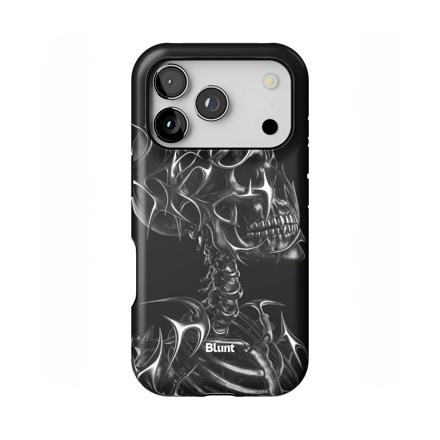 X-Ray iPhone Case