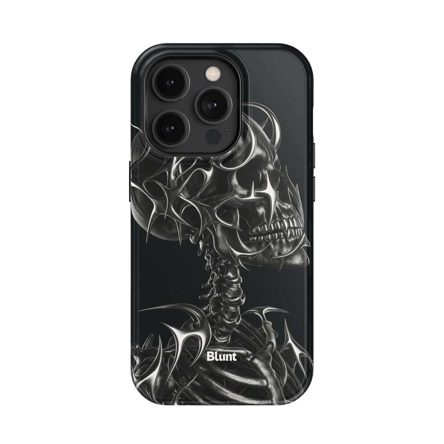 X-Ray iPhone Case