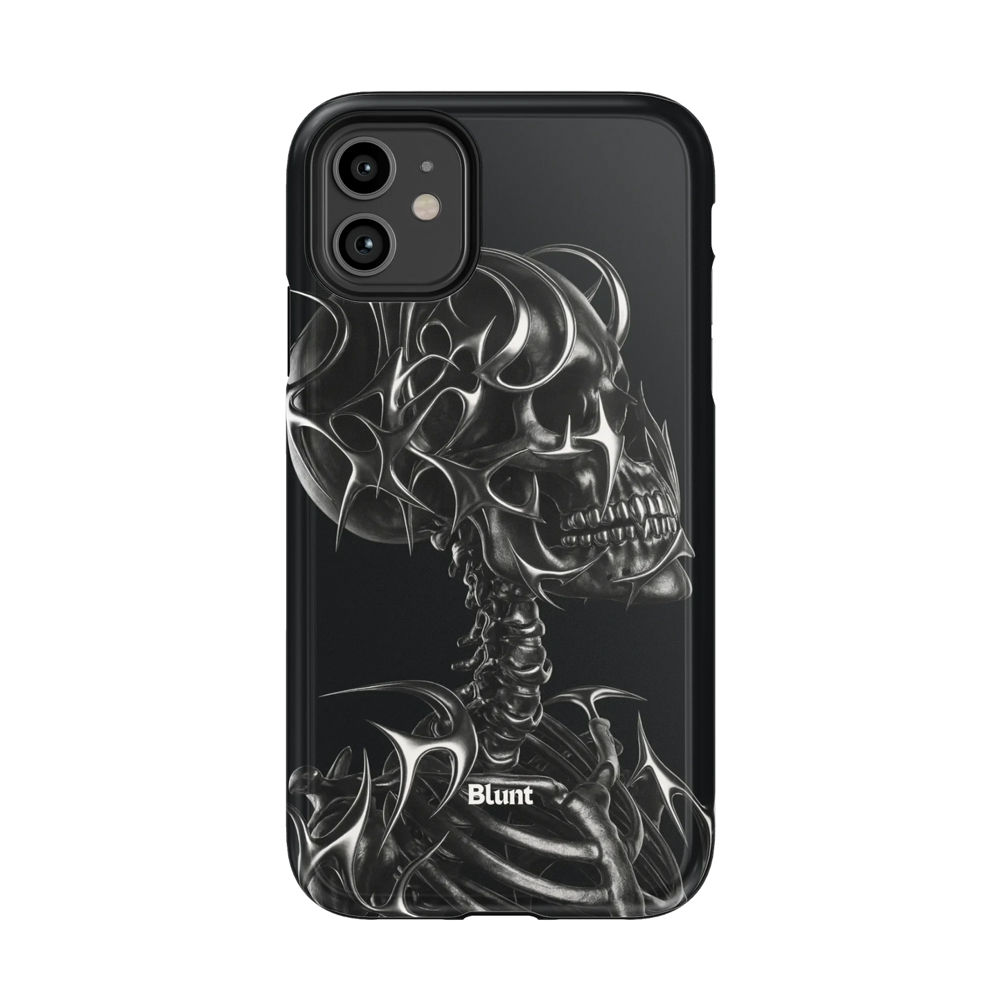 X-Ray iPhone Case