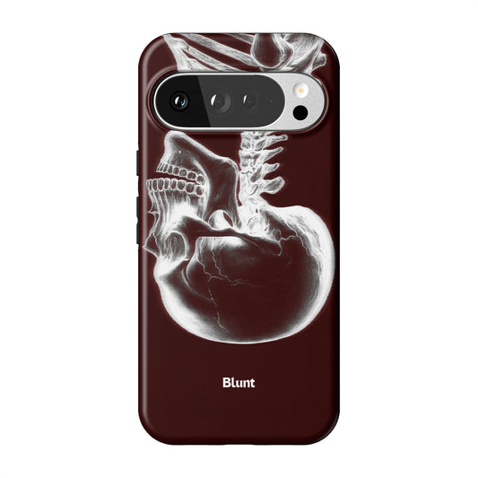 Pixel_10_Pixel_10_Pro_XL_1