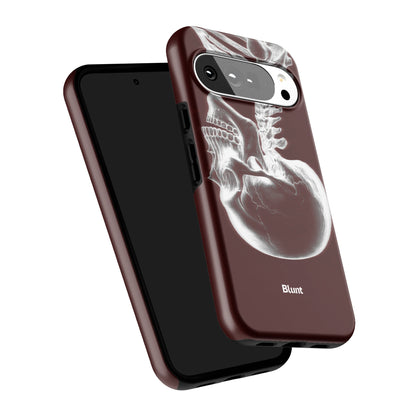 Pixel_10_Pixel_10_Pro_XL_5