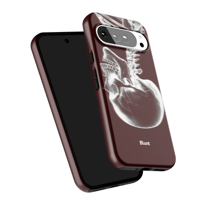 Pixel_9_Pixel_9_Pro_XL_5