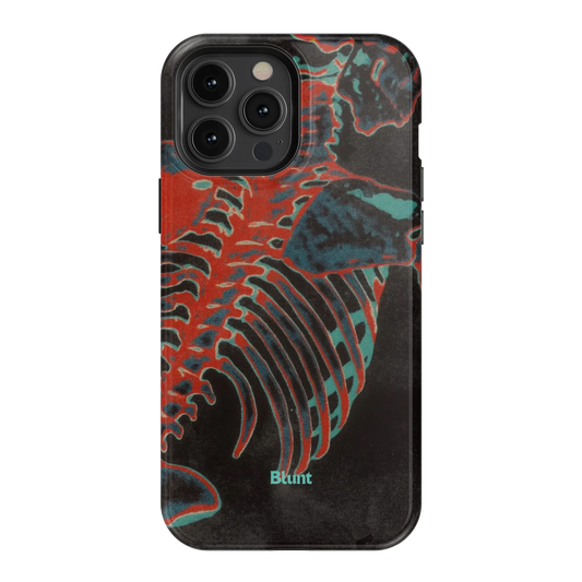 Bone Shredder iPhone Case