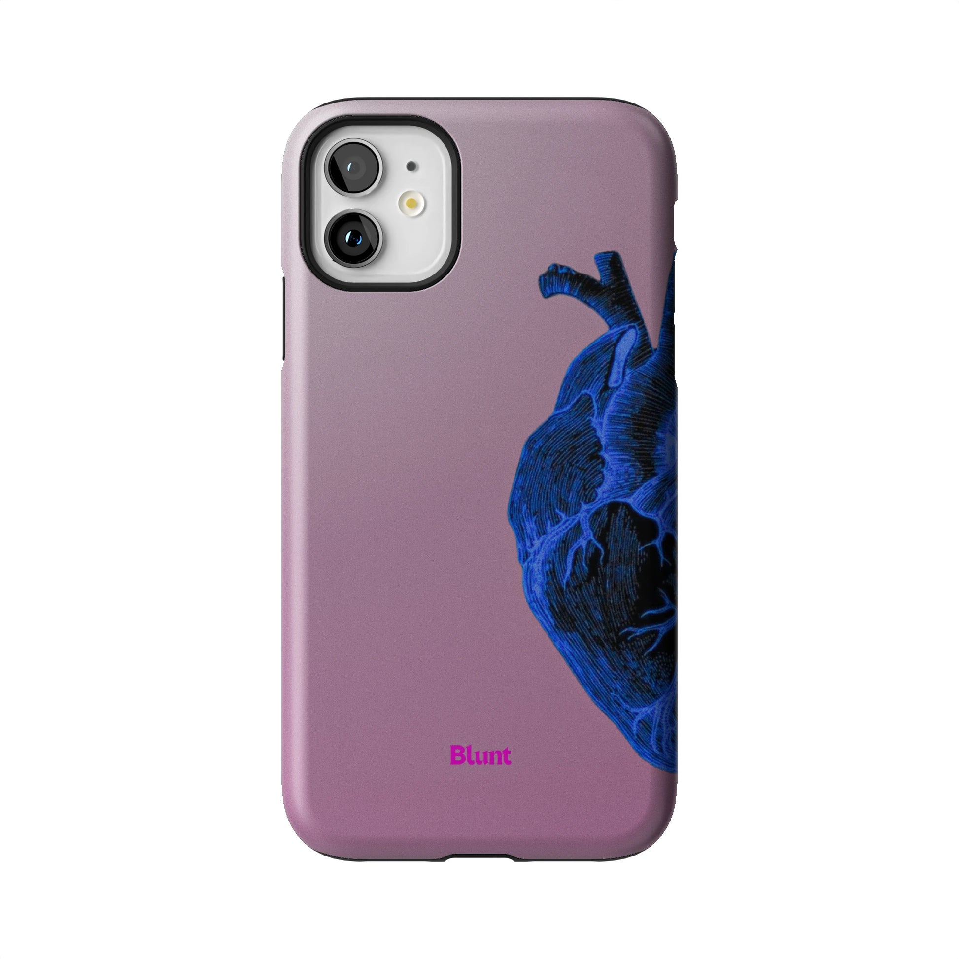 Anatomy Heart Blue iPhone Case gallery - Iphone_11_Iphone_1