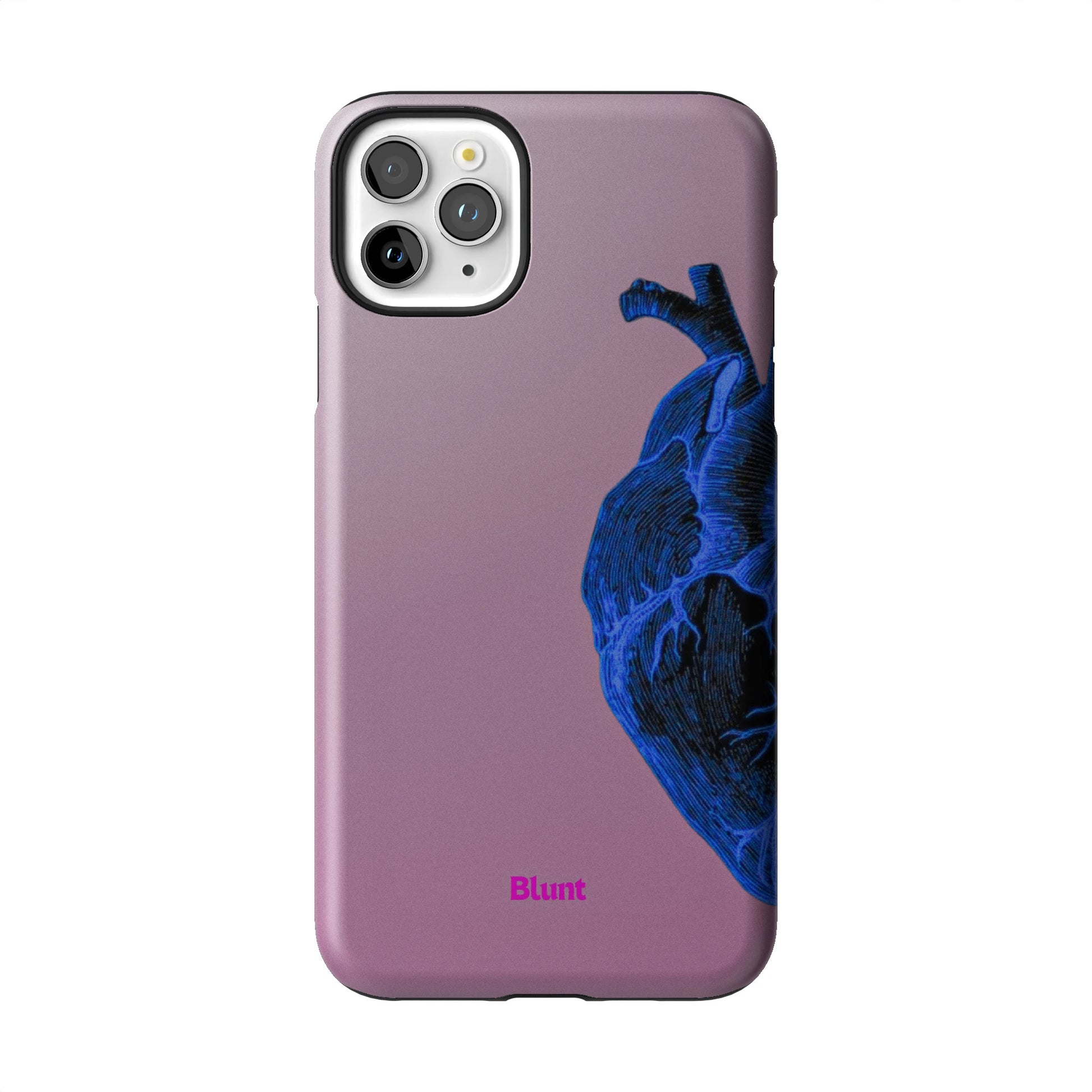 Anatomy Heart Blue iPhone Case gallery - Iphone_11_Pro_Max_1