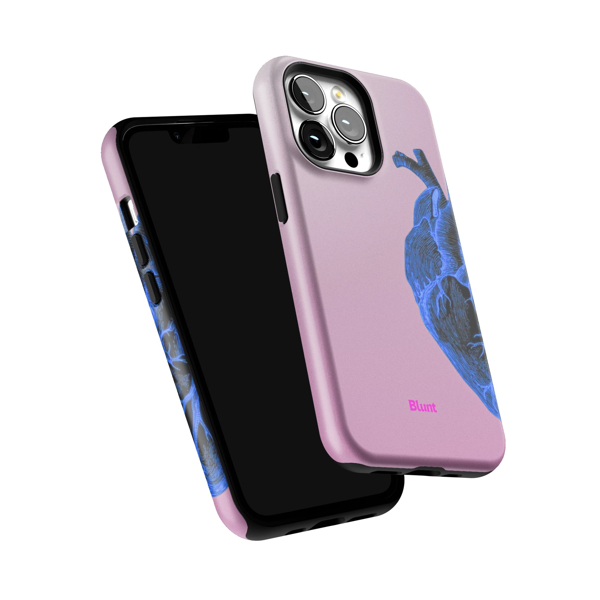 Anatomy Heart Blue iPhone Case gallery - Iphone_13_Pro_6