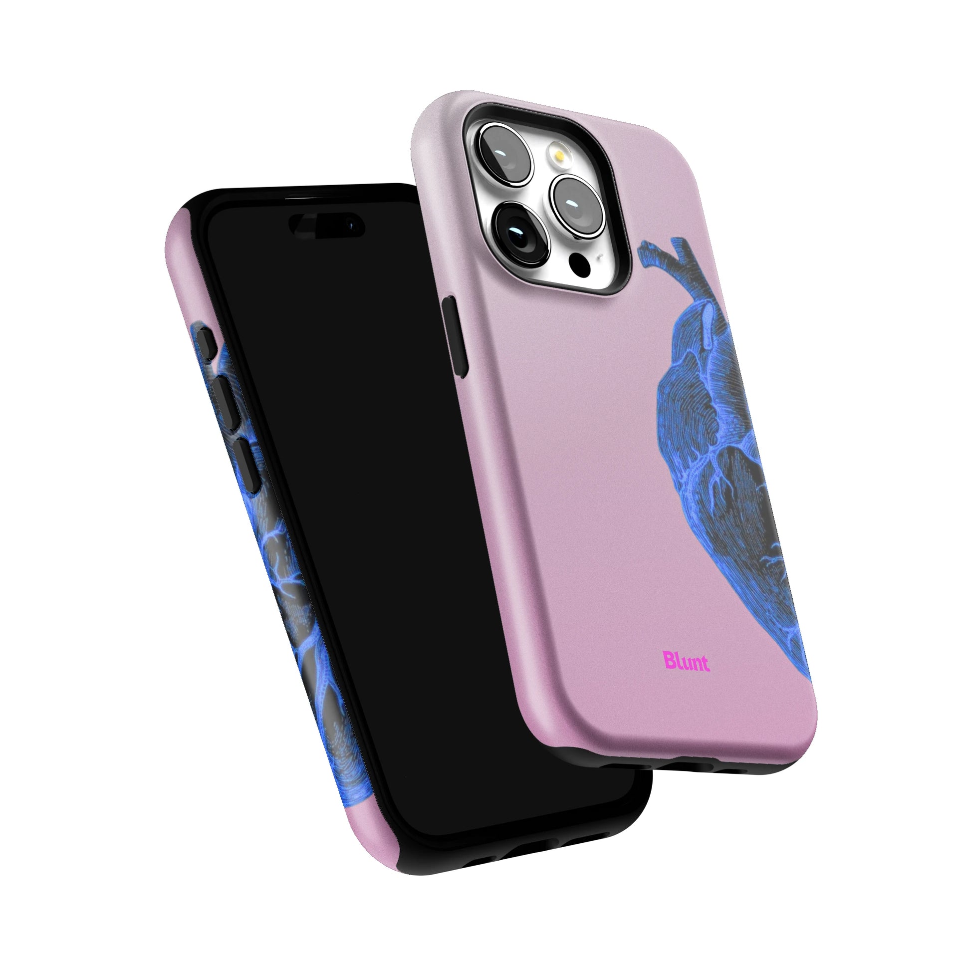 Anatomy Heart Blue iPhone Case gallery - Iphone_15_Pro_6