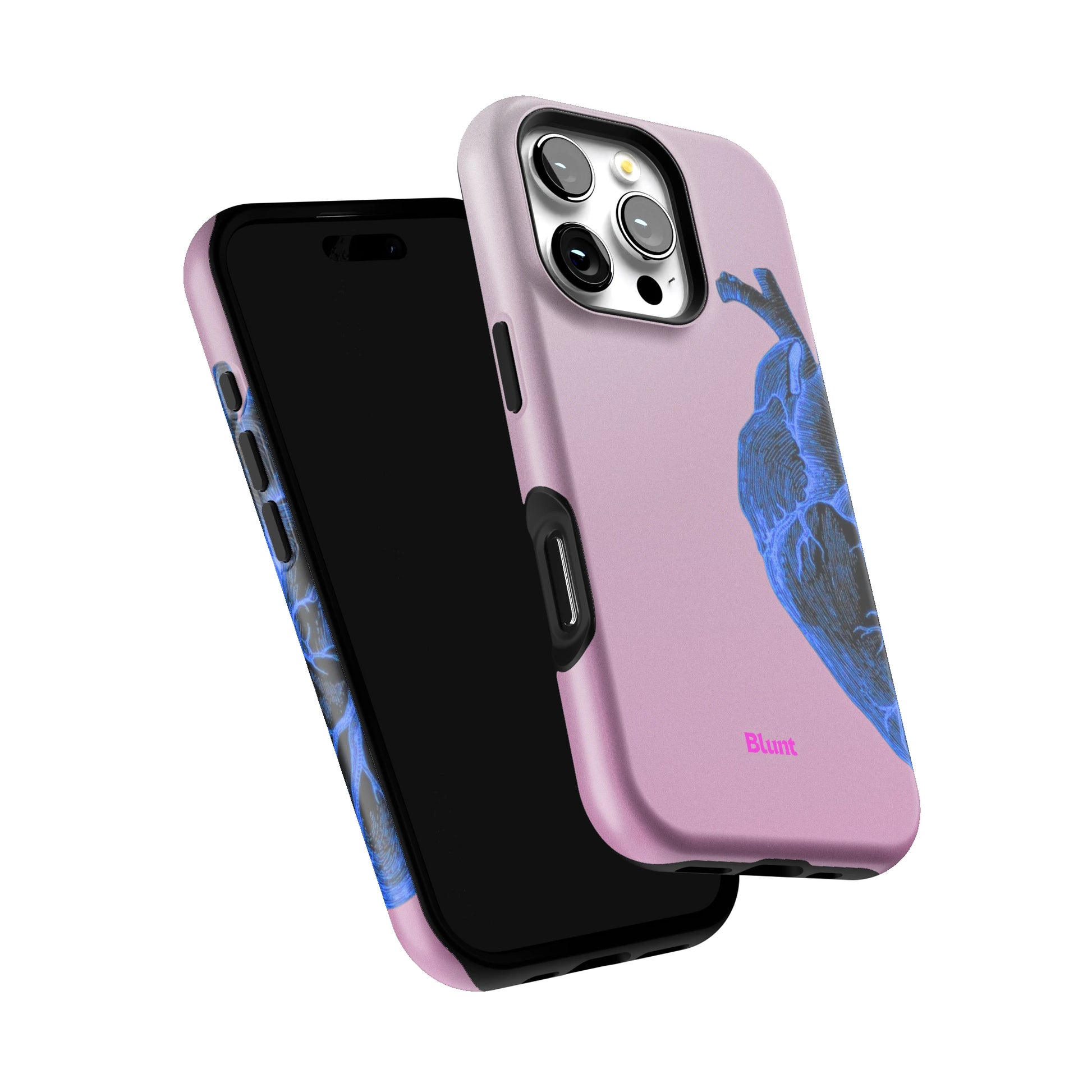 Anatomy Heart Blue iPhone Case gallery - Iphone_16_Pro_6