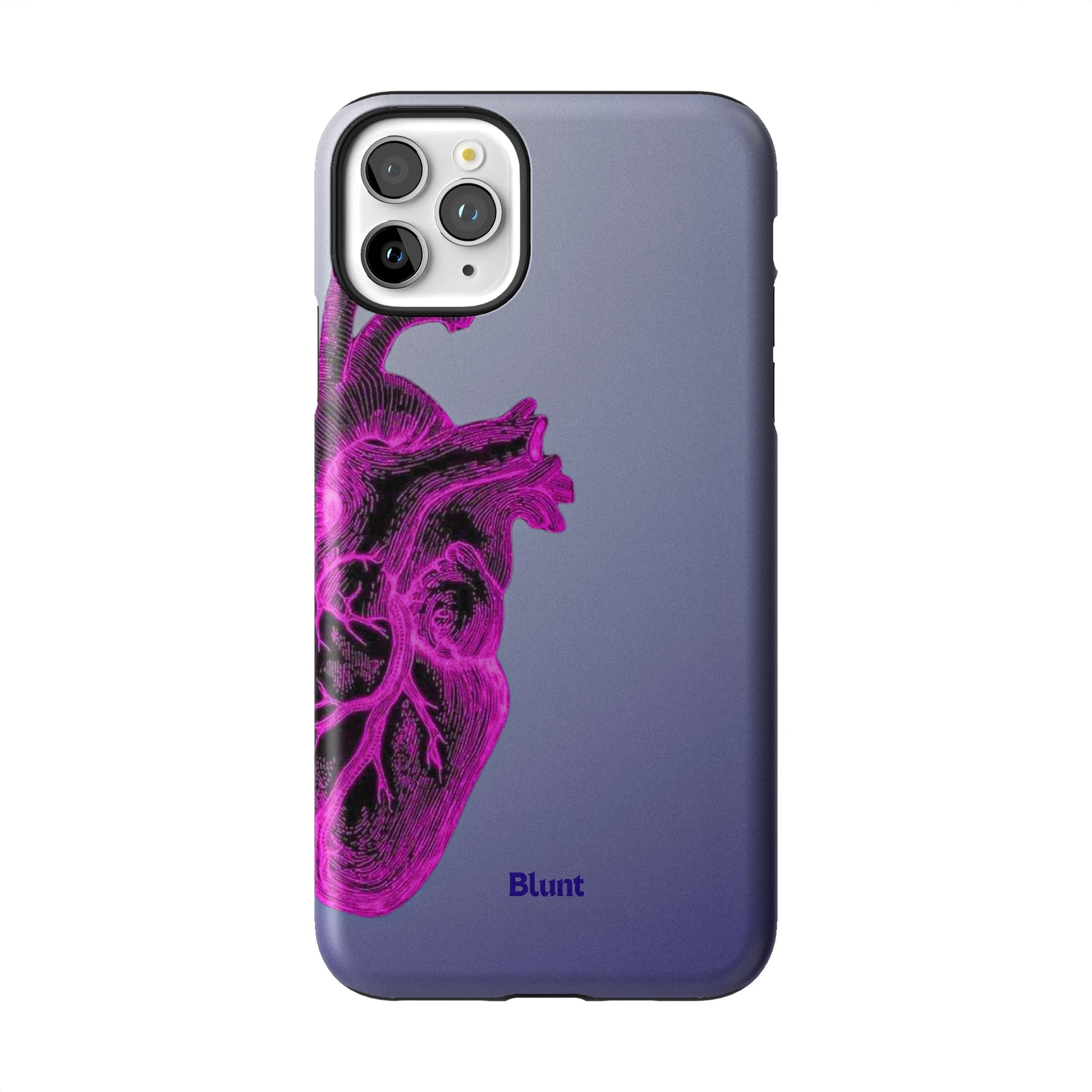 Anatomy Heart Pink iPhone Case gallery - Iphone_11_Pro_Max_1
