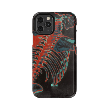 Bone Shredder iPhone Case