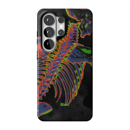 Toxic Ribs Samsung Case