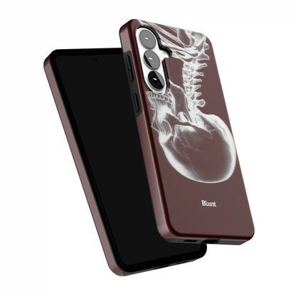 Crimson-Cranium-samsung-case-Galaxy S26 Plus-5