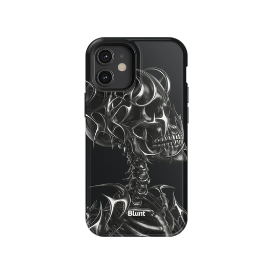 X-Ray iPhone Case