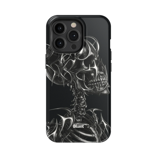 X-Ray iPhone Case