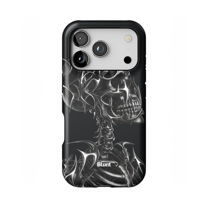 X-Ray iPhone Case