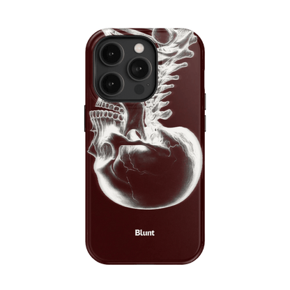 Crimson Cranium iPhone Case - Blunt Cases