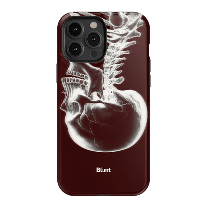 Crimson Cranium iPhone Case - Blunt Cases