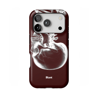 Crimson Cranium iPhone Case - Blunt Cases