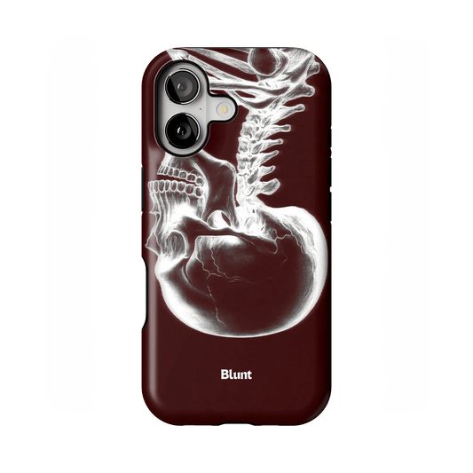 Crimson Cranium iPhone Case - Blunt Cases