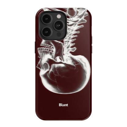Crimson Cranium iPhone Case - Blunt Cases