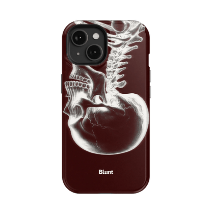 Crimson Cranium iPhone Case - Blunt Cases