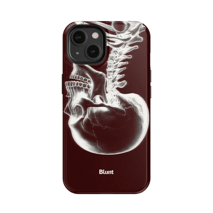 Crimson Cranium iPhone Case - Blunt Cases