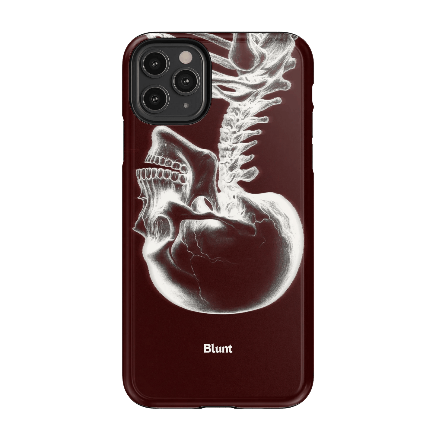 Crimson Cranium iPhone Case - Blunt Cases