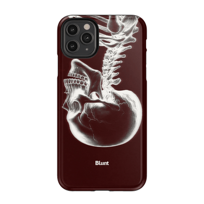 Crimson Cranium iPhone Case - Blunt Cases