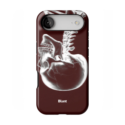 Crimson Cranium iPhone Case - Blunt Cases