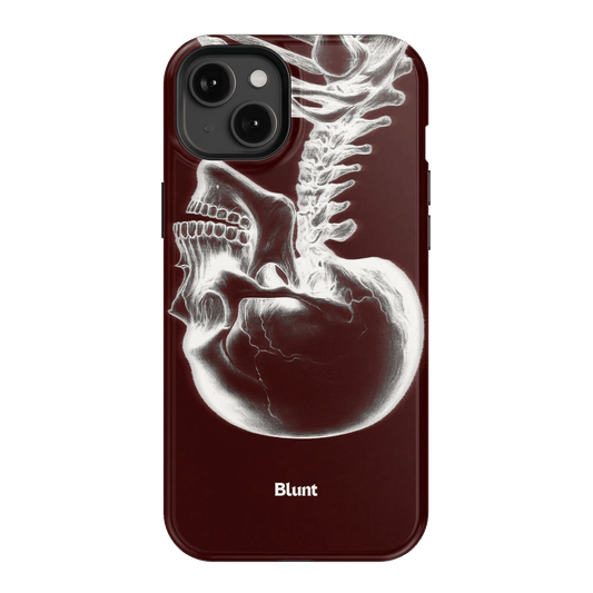 Crimson Cranium iPhone Case - Blunt Cases