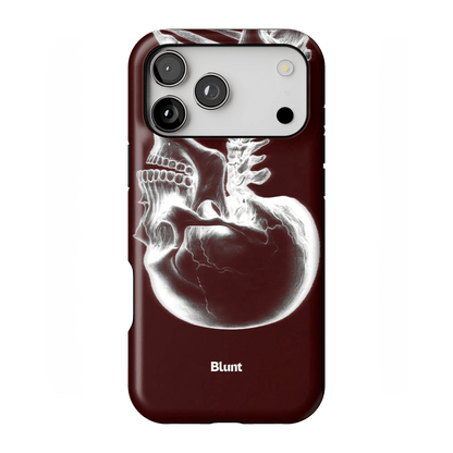 Crimson Cranium iPhone Case - Blunt Cases