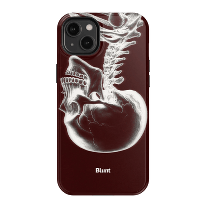 Crimson Cranium iPhone Case - Blunt Cases