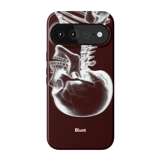 Crimson Cranium Pixel Case - Blunt Cases