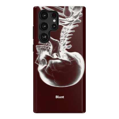 Crimson Cranium Samsung Case - Blunt Cases