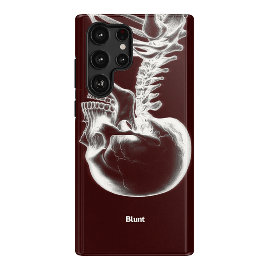 Crimson Cranium Samsung Case - Blunt Cases