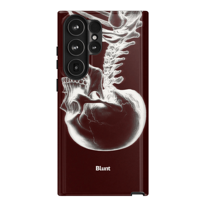 Crimson Cranium Samsung Case - Blunt Cases