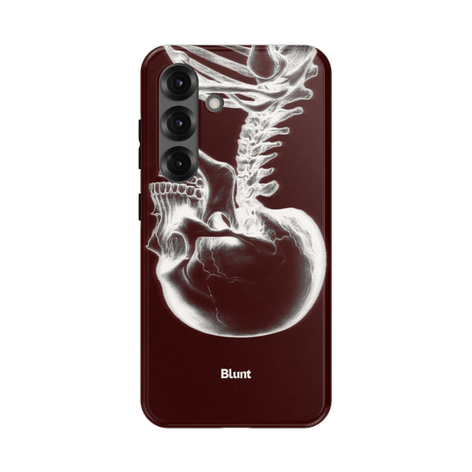 Crimson Cranium Samsung Case - Blunt Cases