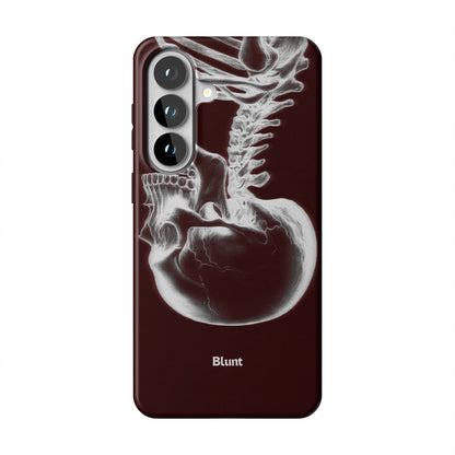 Crimson Cranium Samsung Case