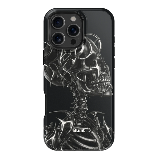 X-Ray iPhone Case
