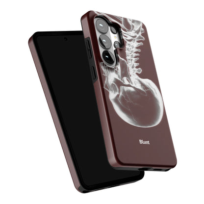Crimson-Cranium-samsung-case-Galaxy S26 Ultra-5