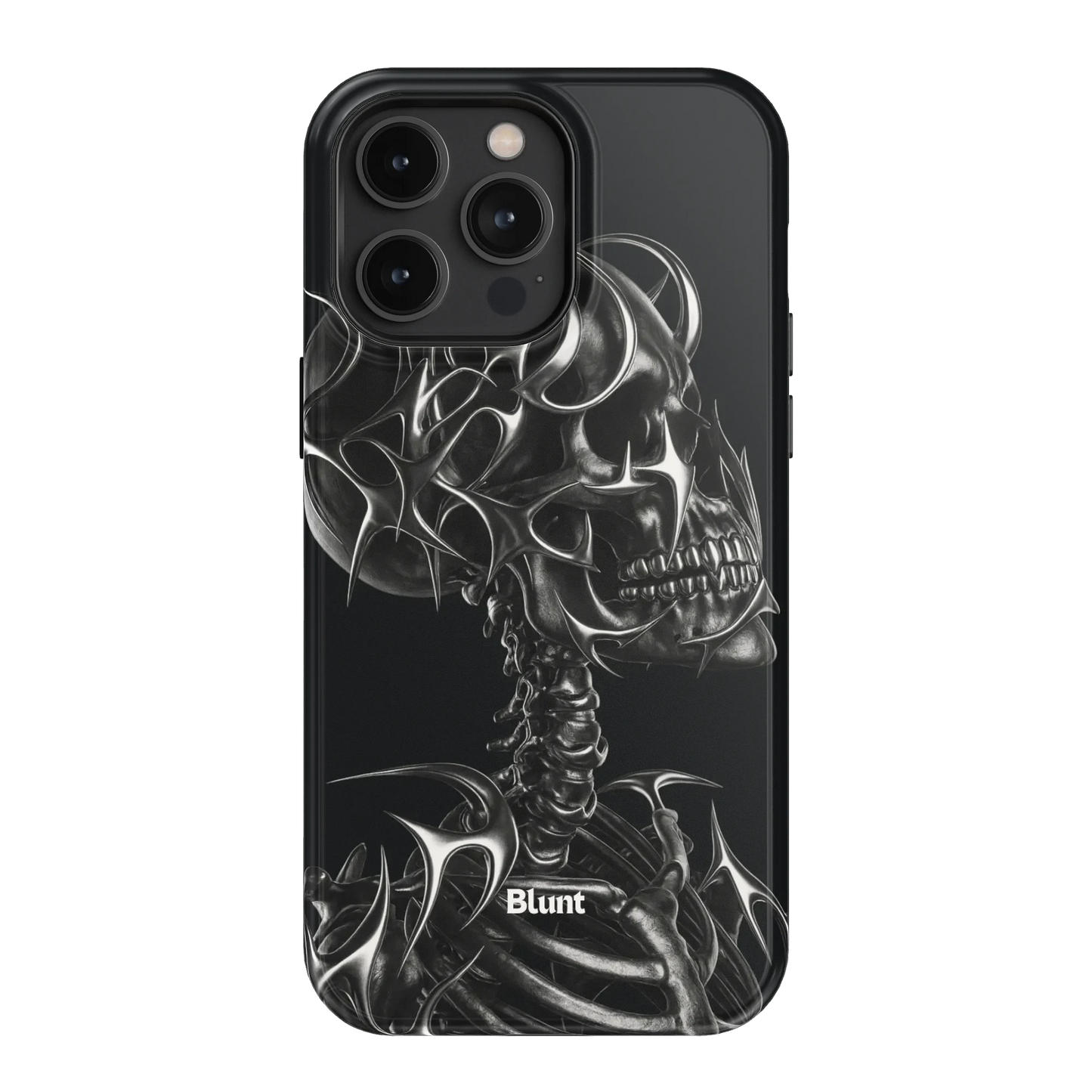 X-Ray iPhone Case