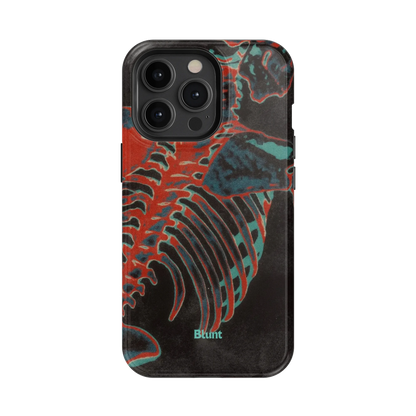 Bone Shredder iPhone Case