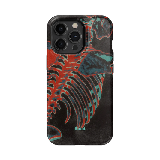 Bone Shredder iPhone Case